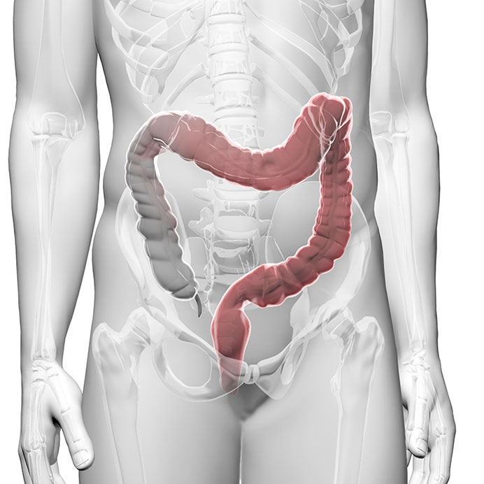 Illustration Colitis