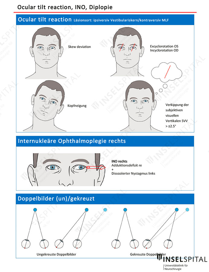 Neuropocket Beispielseite